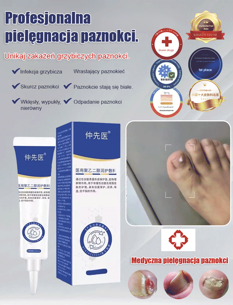 [Rozwiązanie problemu z paznokciami] Antybakteryjny krem naprawczy na grzybicę paznokci