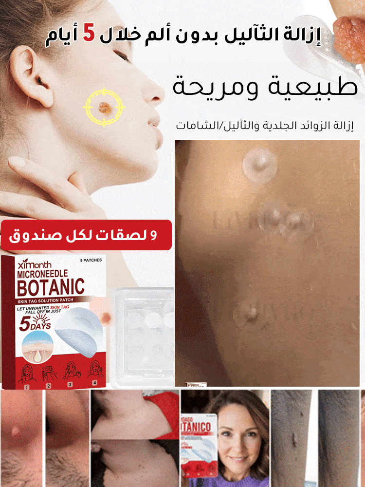 لصقات العناية بالبشرة لإزالة الثآليل من الوجه والجسم