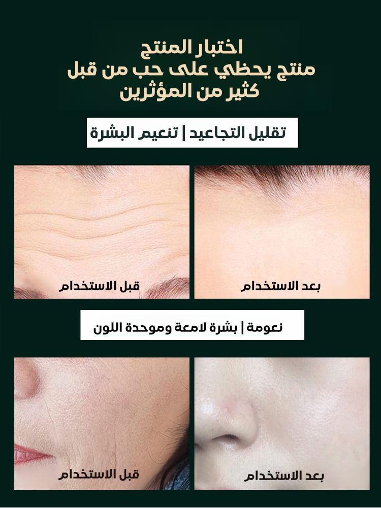 قناع الجبين المجفف بالتجميد بالببتيدات الحلزونية