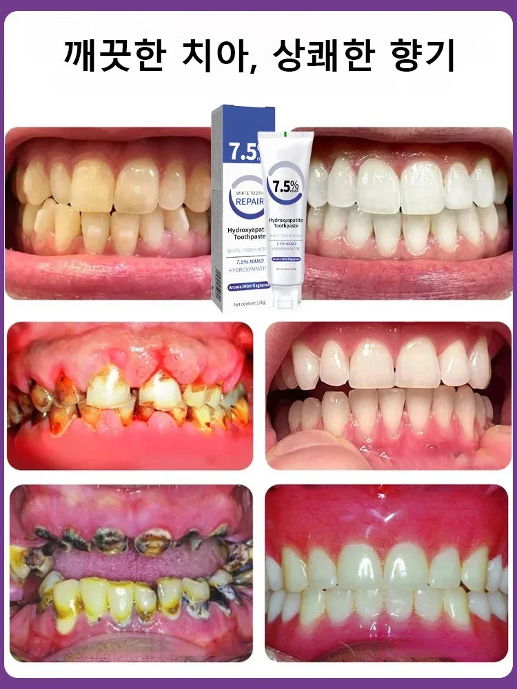 【치아 문제 한 번에 해결】하이드록시아파타이트 치약