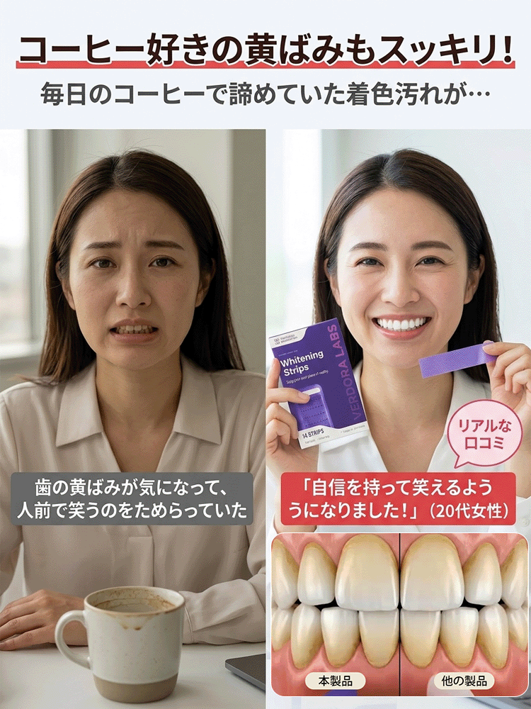ホワイトニングシート