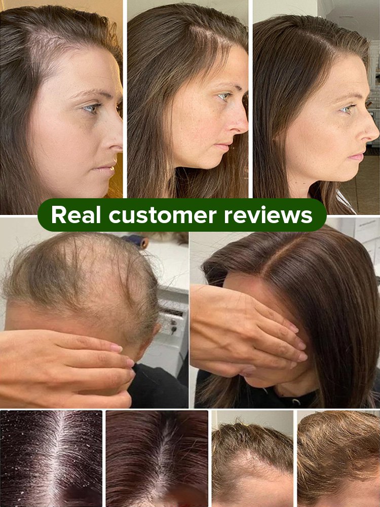 【10x Rapid Growth】Natural He Shou Wu Hair Growth Soap