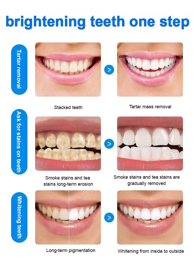 Ultraviolet sterilization ultrasonic toothbrush