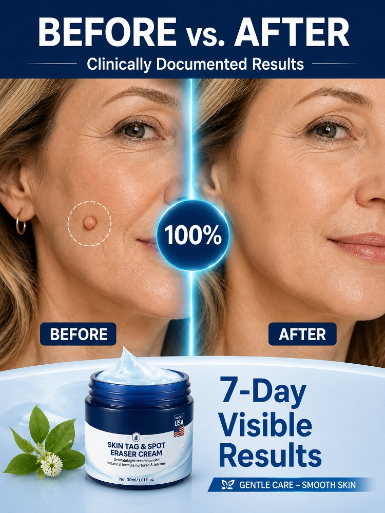 7 Days Fast Skin Growth Remover Cream