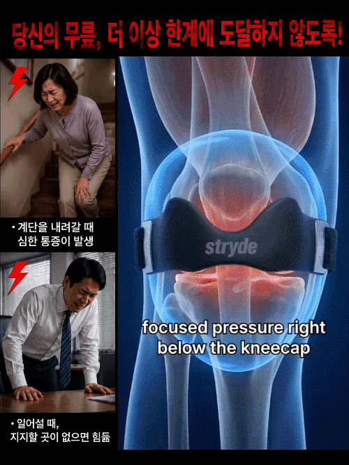 무중력·생체 모방 외골격 슬개골 밴드