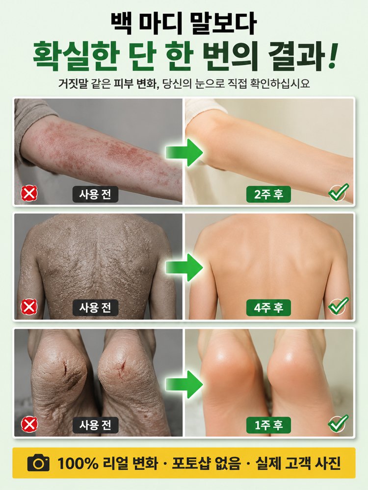 【피부염 집중 케어】피부 진정 케어 크림
