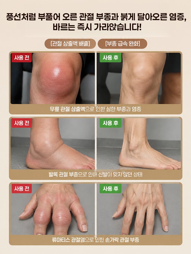 독일 군용 3D 뼈침투 관절 재생크림