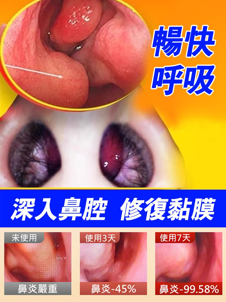 【一噴通鼻】西藏非遺鼻腔修復液