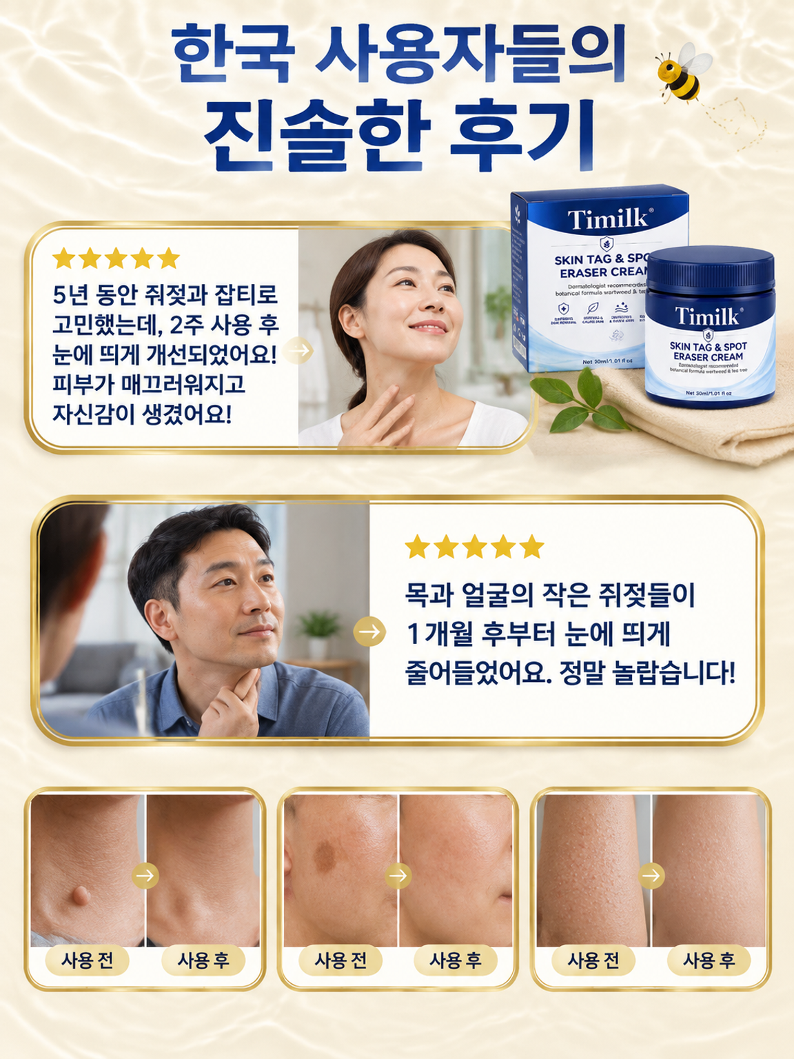 7일 피부 사마귀 제거 크림