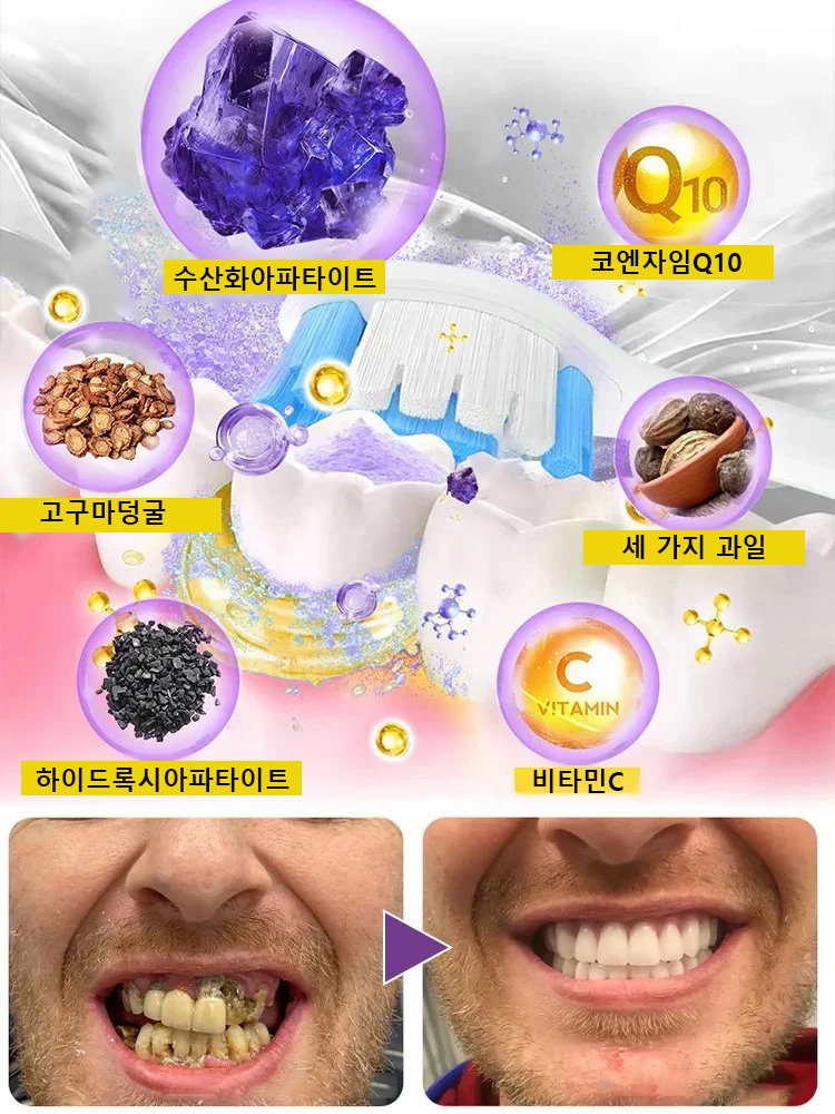 【치아 문제 한 번에 해결】하이드록시아파타이트 치약