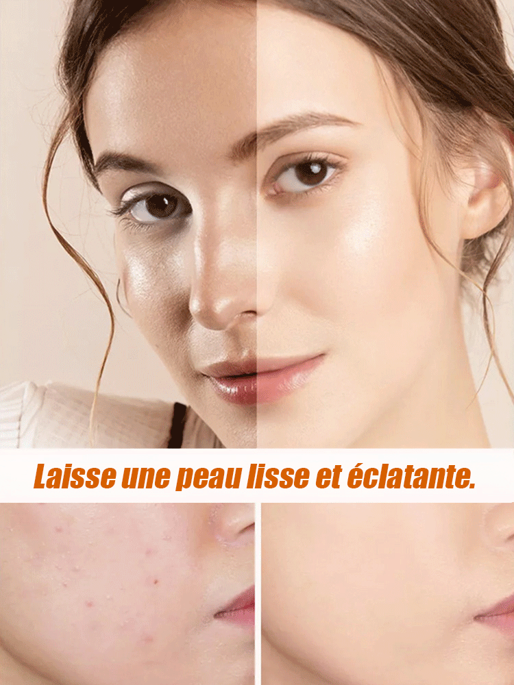 Caviar d'esturgeon noir de la mer Caspienne importé