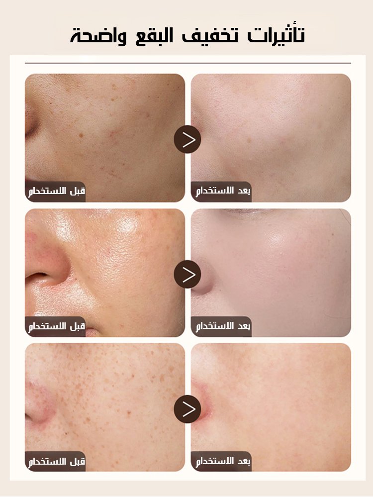 كريم وجه لإشراق البشرة وإزالة البقع 