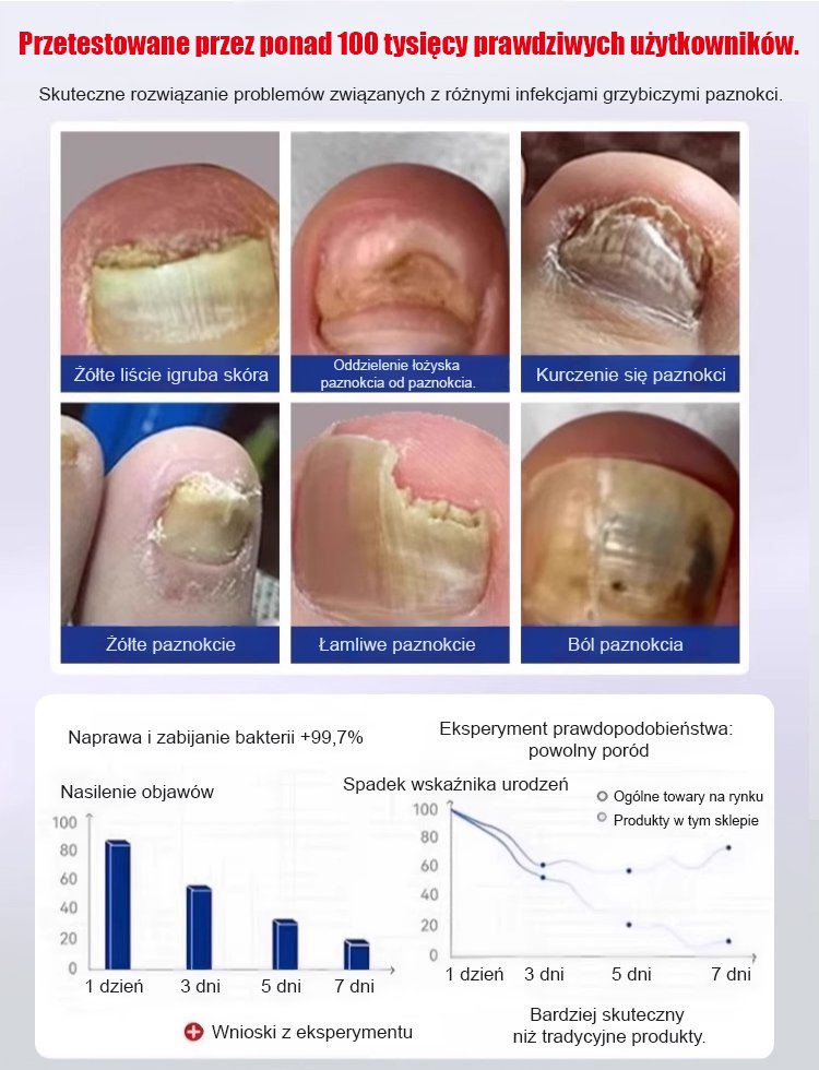 [Rozwiązanie problemu z paznokciami] Antybakteryjny krem naprawczy na grzybicę paznokci