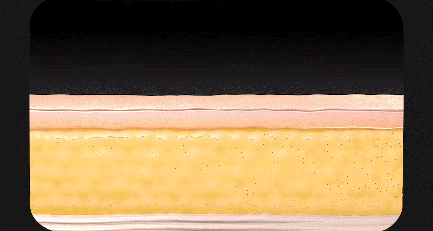 14.gif