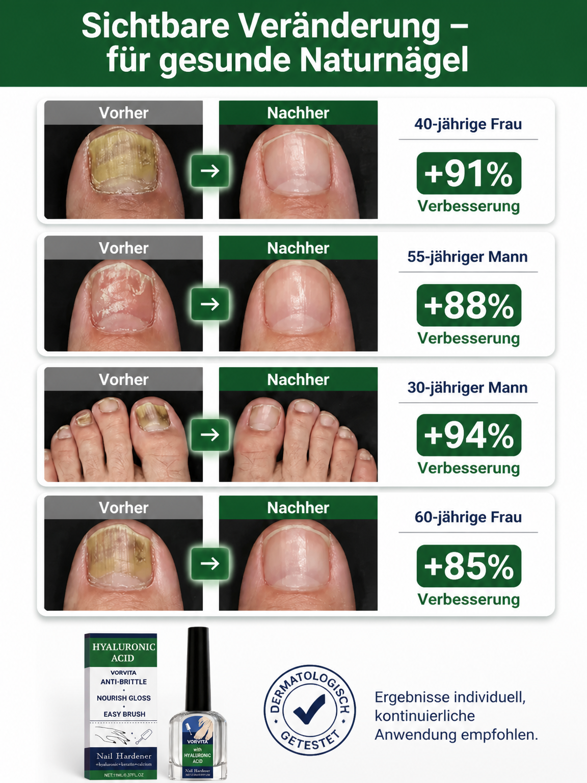 Nagelpflegelösung