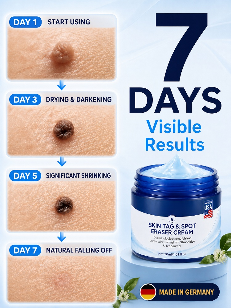 7 Days Fast Skin Growth Remover Cream