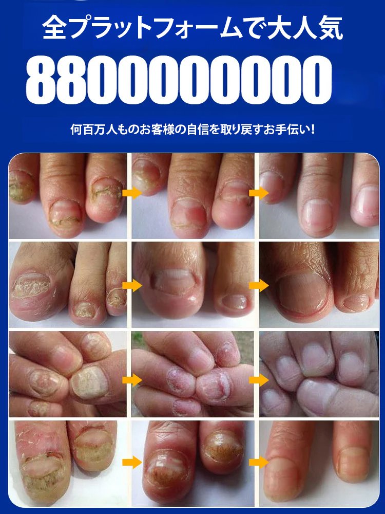 爪美容液