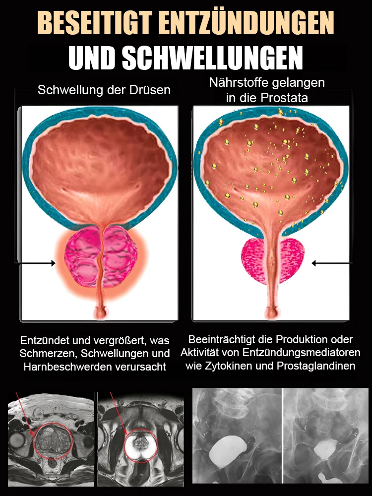 【Globaler Verkaufsschlager】NAD+1000 Anti-Aging-Getränk