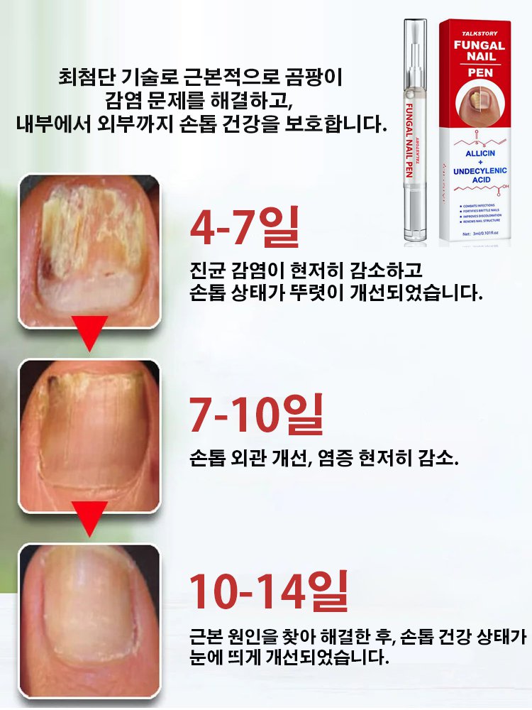 손발톱 무좀 곰팡이 관리 펜