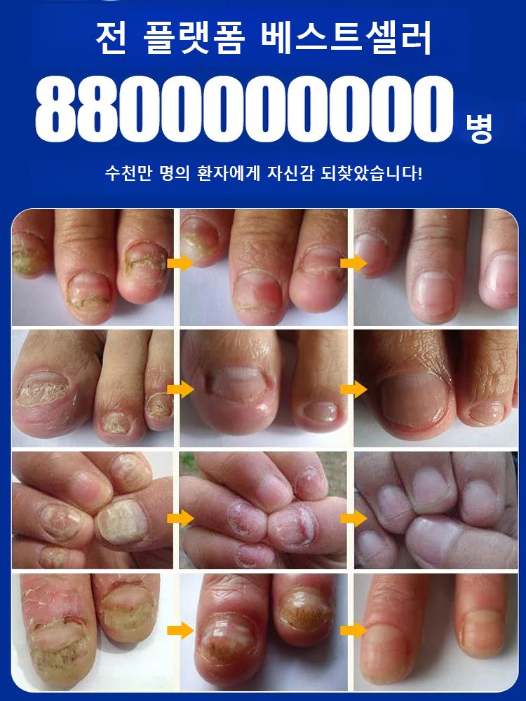 SOUTH MOON 손톱 케어 에센스