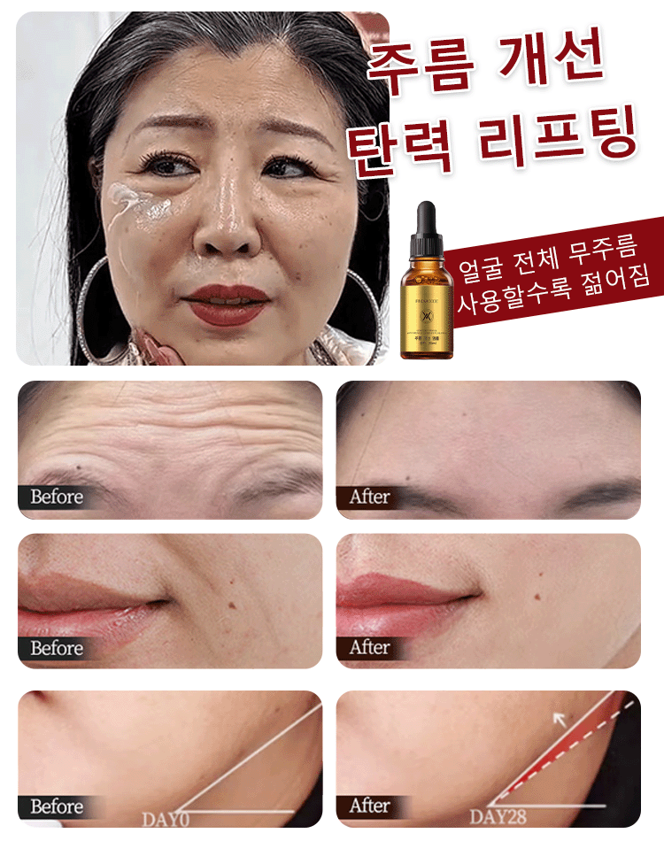 【한 병으로 동안 완성】주름 개선 앰플