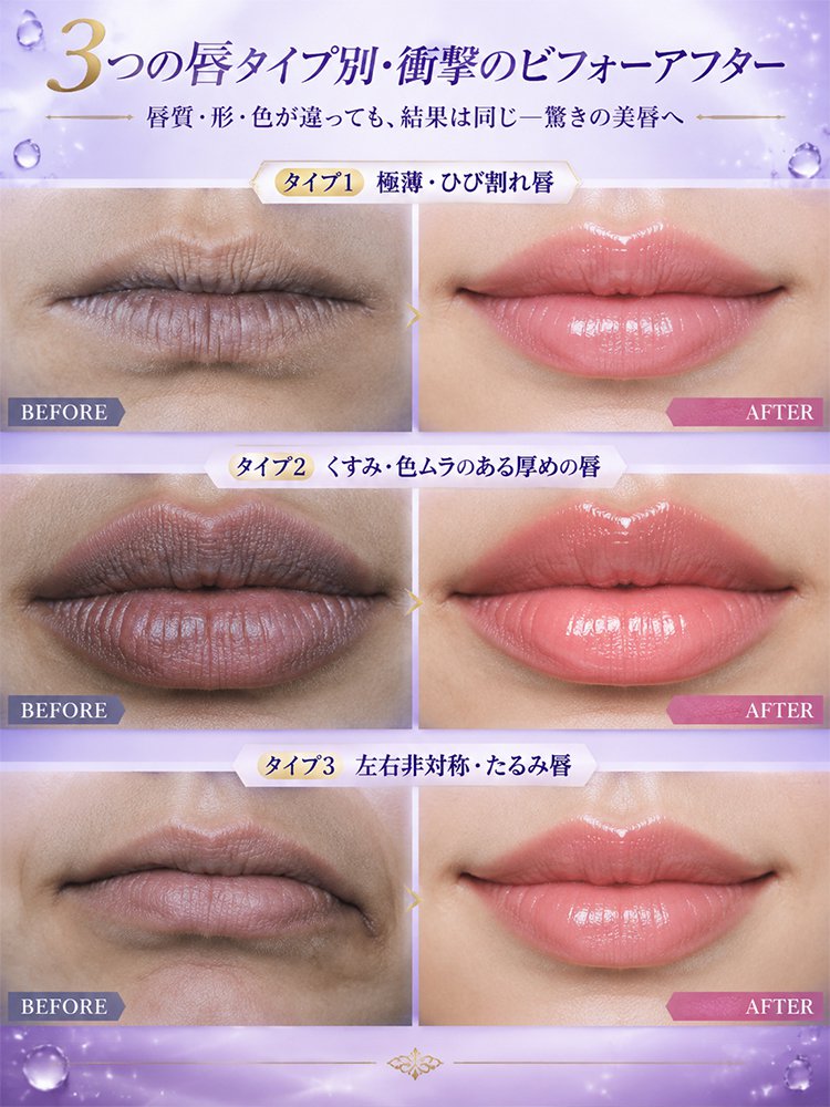 縦ジワをケアする色付きリップ美容液