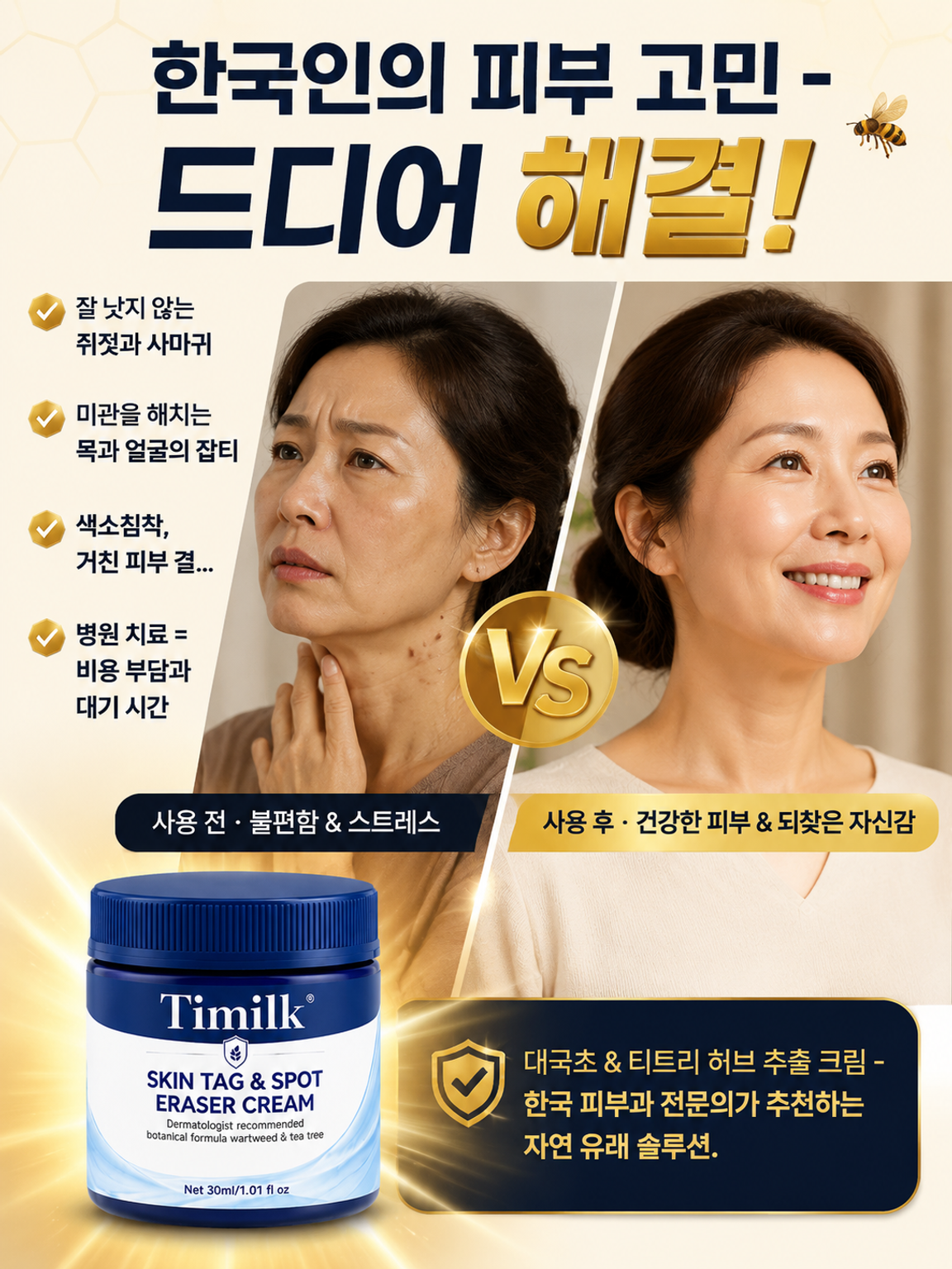 7일 피부 사마귀 제거 크림