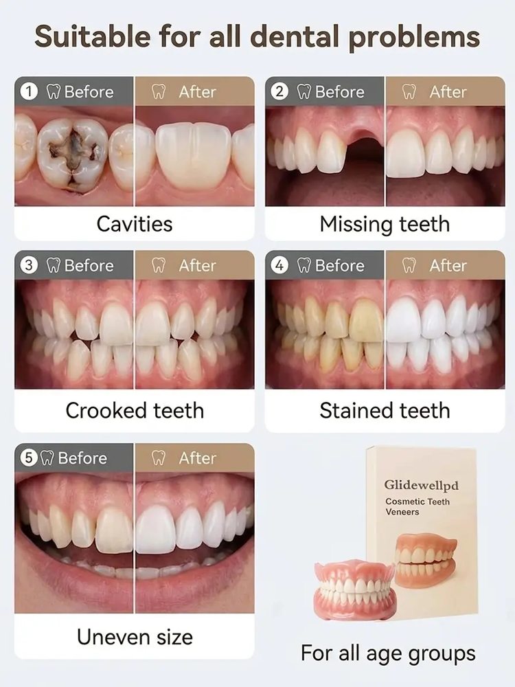  [Epic Upgrade] Premium Full Cover Dentures