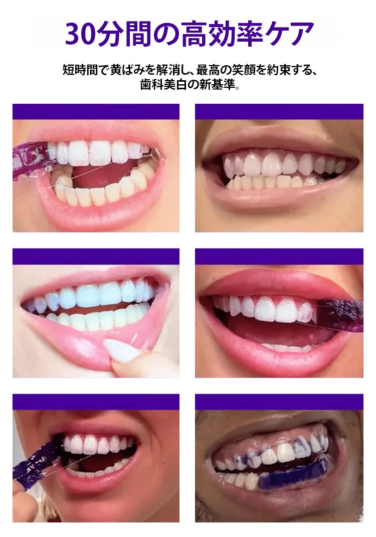 翻译件-FM-一贴白展现自信笑容爆款美白去黄牙贴-1341273_17.jpg