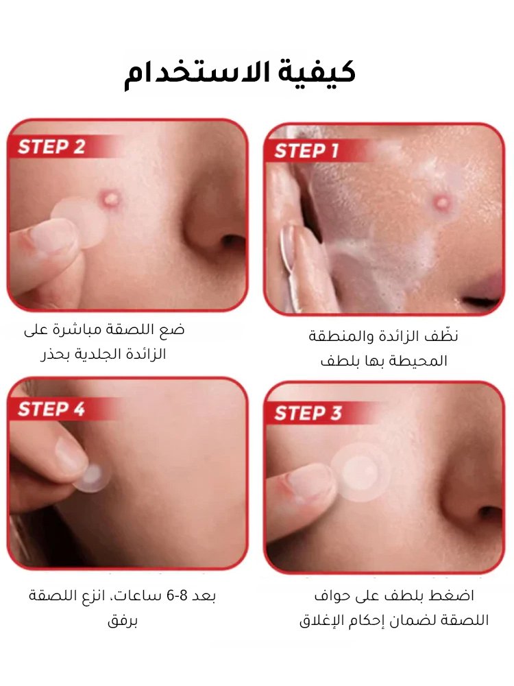 لصقات العناية بالبشرة لإزالة الثآليل من الوجه والجسم