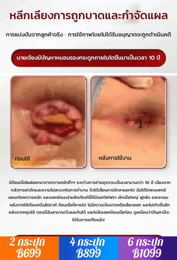 ยารักษาริดสีดวงฝูหลิง ดอกไหว ผักเบี้ย และชะเอมเทศอัดเม็ด