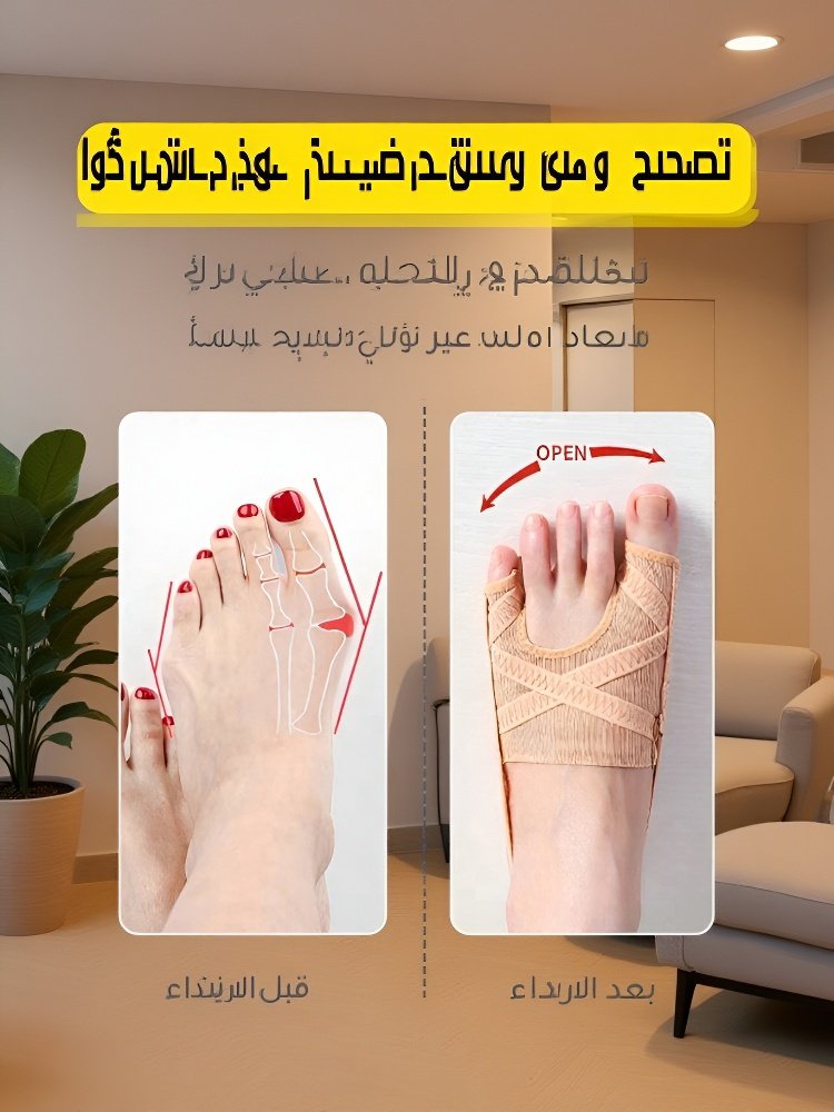 دعامة إصلاح إبهام القدم الأروح من نسيج شبكي