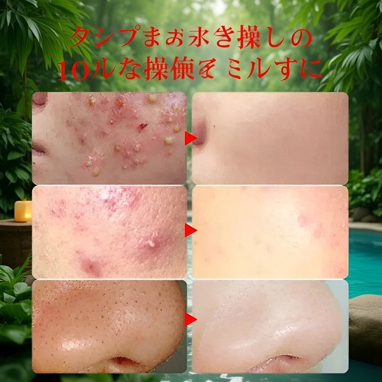 毛穴ケア専用キット