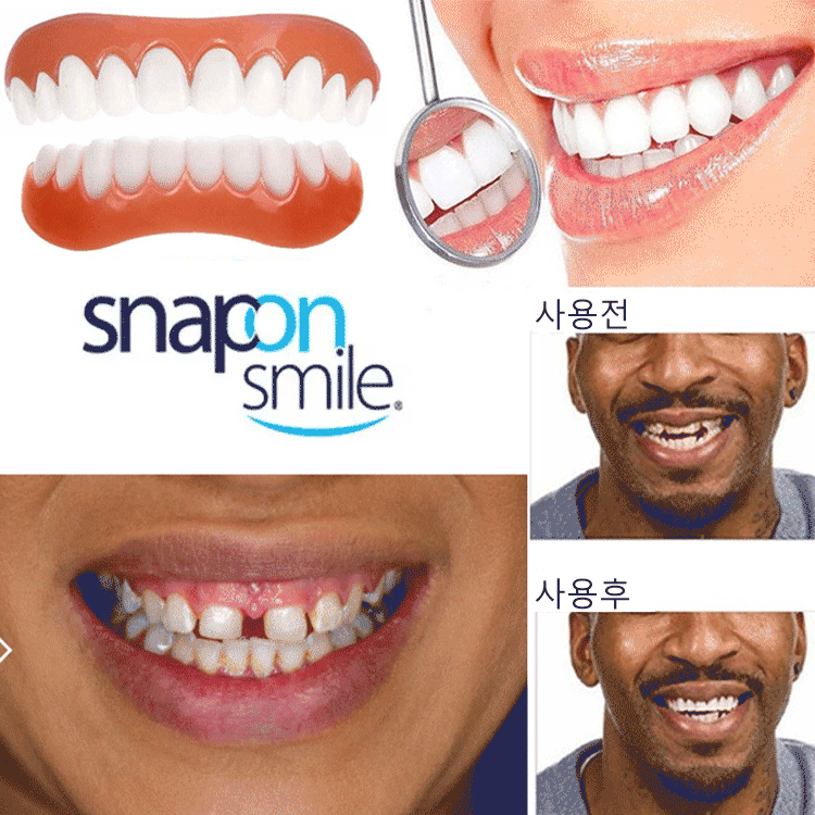 Snapon Smile 미백 치아교정기