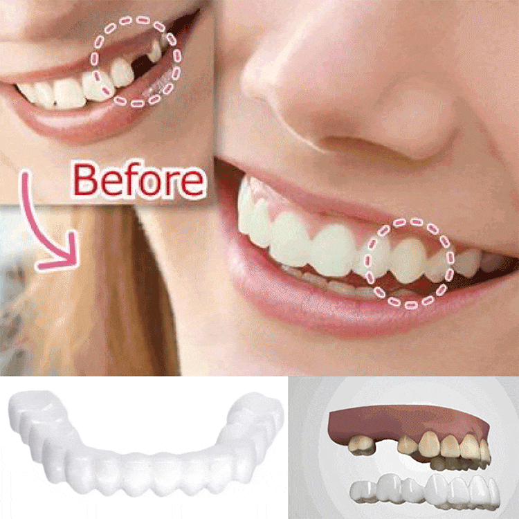 시뮬레이션 마우스피스