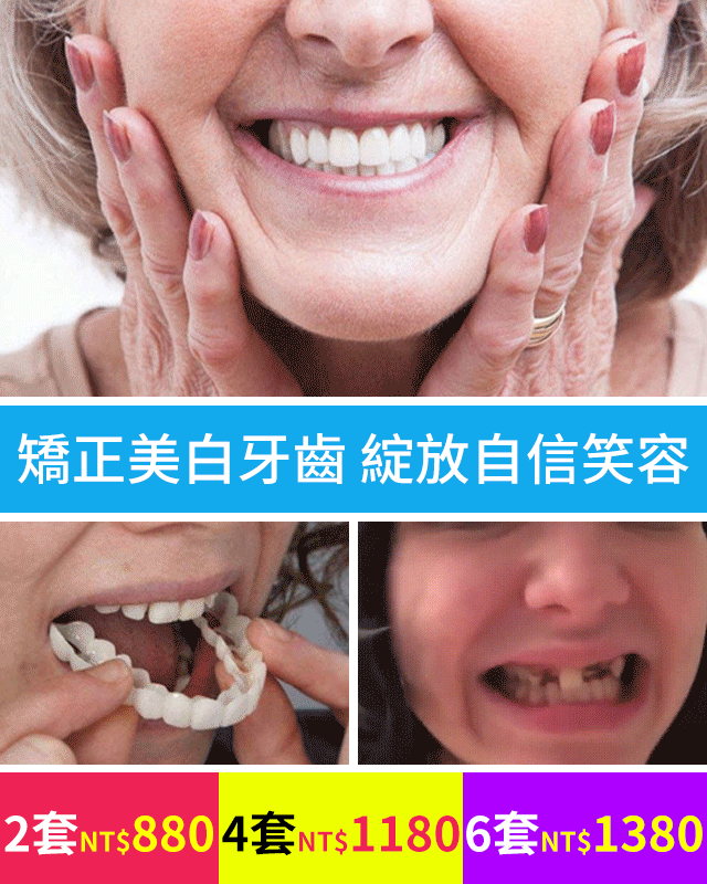 【隱形 美白 】snaponsmile第三代牙套套裝