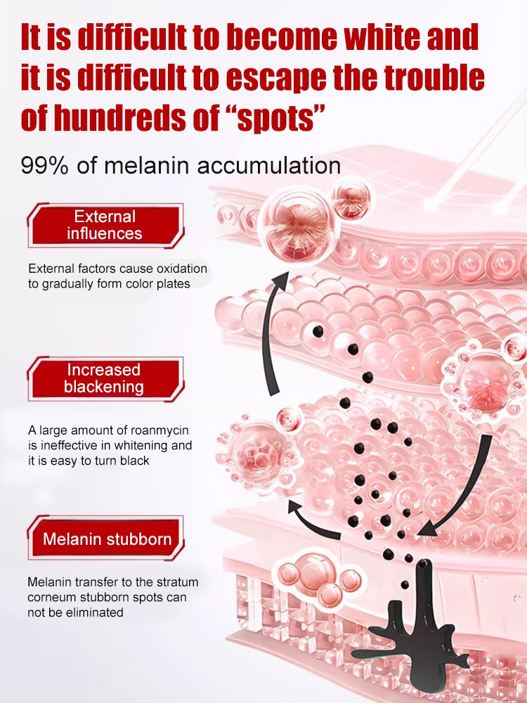 【All kinds of spots can be removed with one spray】Blemish removal, whitening and beauty water