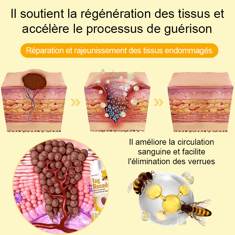 BOOMOON Spray de soin pour verrues au venin d'abeille