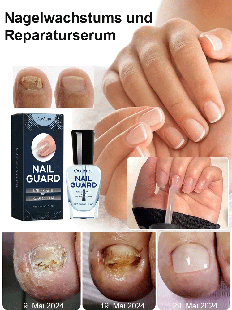 [Zurück zu Ihren gesunden Nägeln] Nail Repair Care Essence