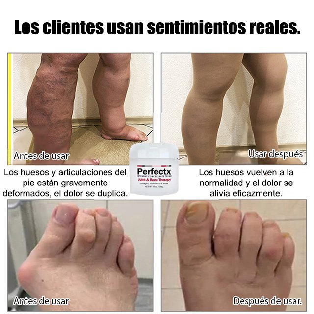 Crema reparadora para las articulaciones