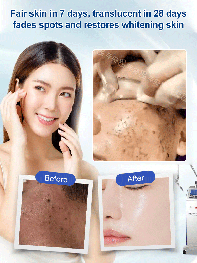【Old Spots and Yellow Spots Disappear】Spot Fading Urea Cream