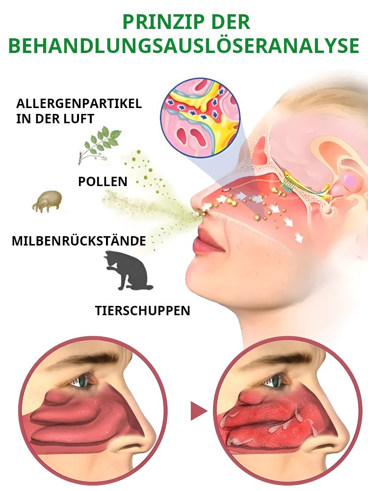 Nasendilatator-Massagegerät zur Heilung von Rhinitis