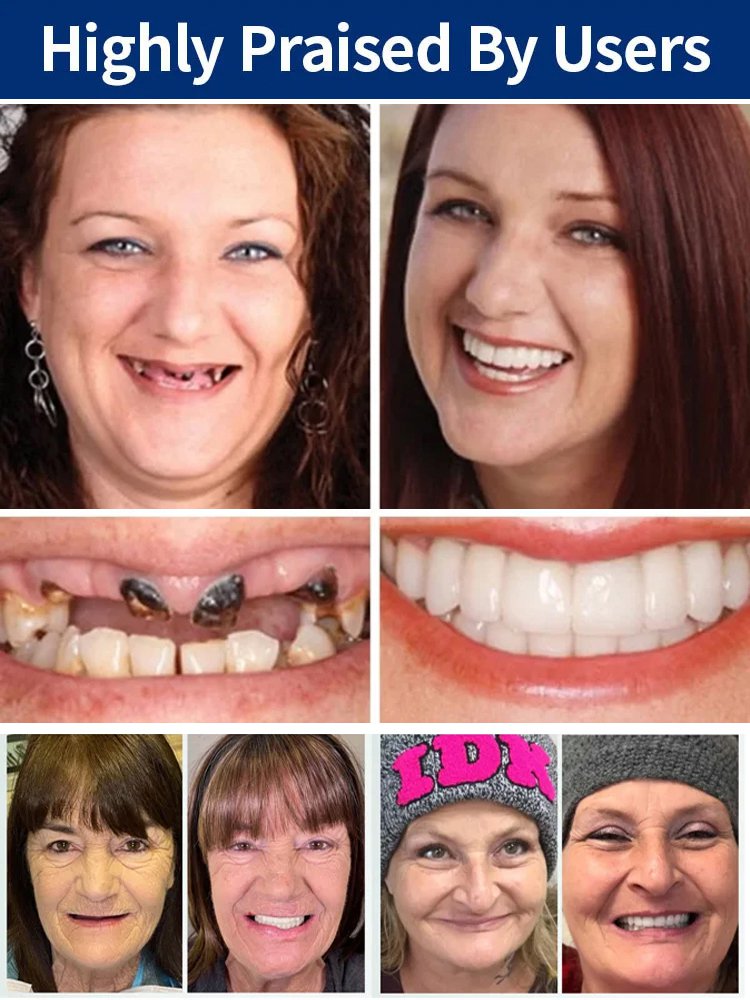 [Trustworthy Quality] Natural and Realistic Complete Dentures