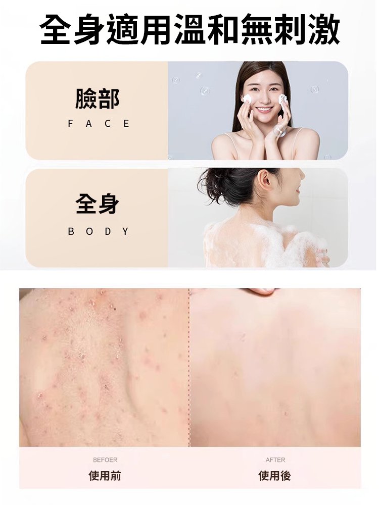 【除蟎淨痘絲滑滋養】奢華黃金皂