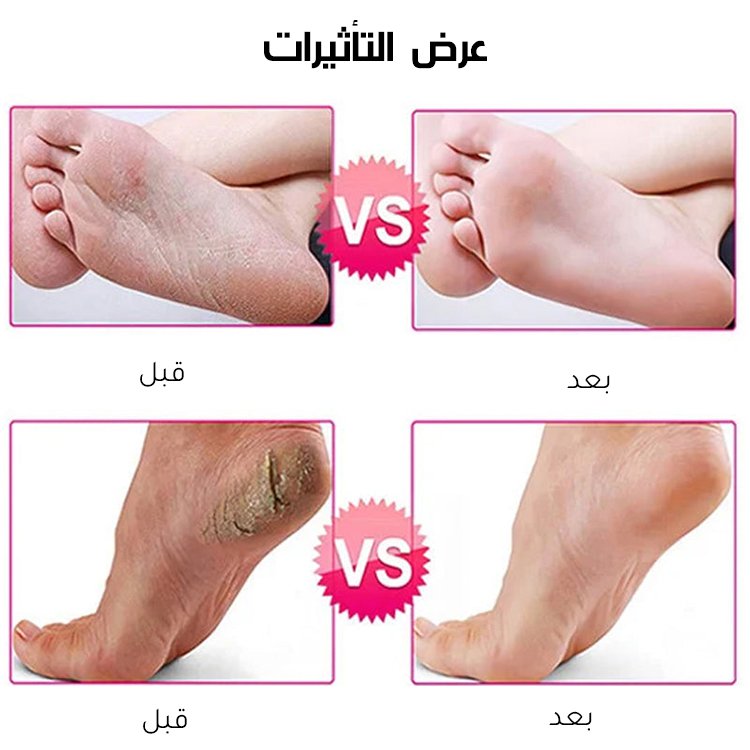 مبرد القدم الكهربائي