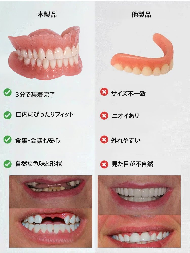 審美用マウスピース，スイス輸入品、口いっぱいのスイス製、そして高貴な身分の象徴！！