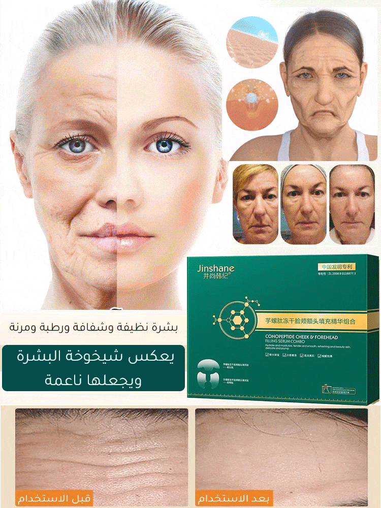 [رقعة تجديد] رقعة قناع الجبين كونو الببتيد المجفف بالتجميد