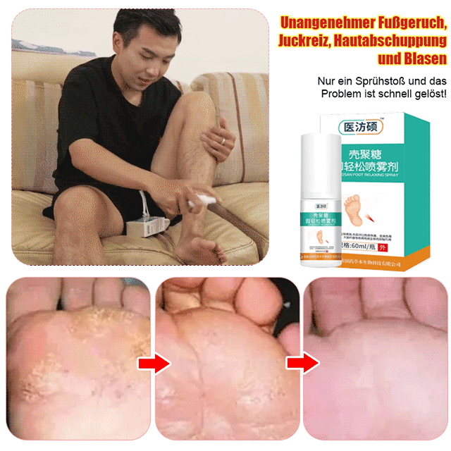Medizinisches Chitosan Fußentspannungsspray