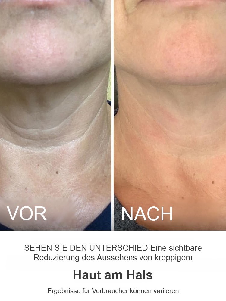 [Monatsverkauf 50.000 Stück] Kollagen-Retinol-Anti-Aging-Creme