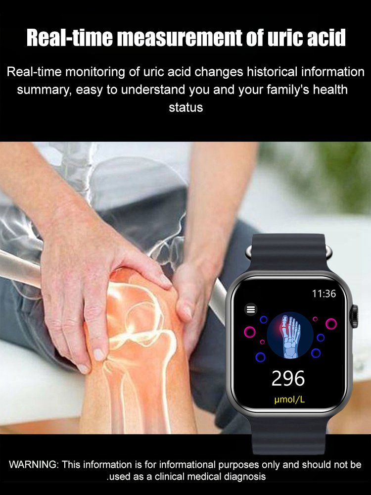 Smart Non-invasive Blood Glucose Uric Acid Watch